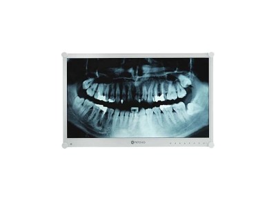 Neovo 24" DR-24G Dental Monitor, 1920x1080 FULL HD IPS, 5ms, HDMI, VGA, DP